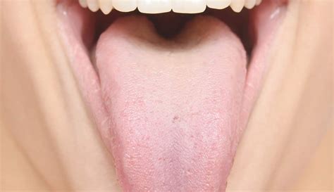 What Does Our Tongue Tell Us About Our Liver