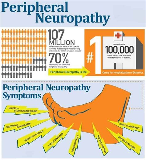 8 Most Common Signs You Might Have Neuropathy