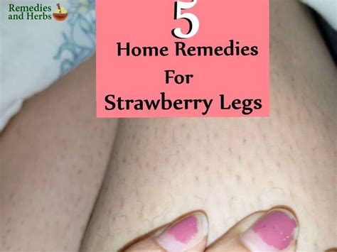 Will bleach kill hair follicles? Easy Skin Care Tips You Should Follow | Strawberry legs ...