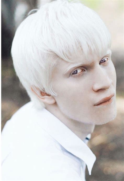 Snow Queen Albino Human Modelo Albino Albino Model Vitiligo Treatment Melanism Character