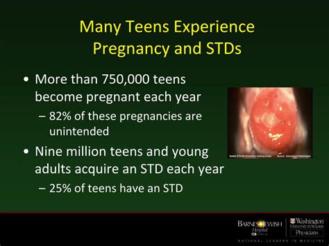 Ppt Stis Iuds And Pelvic Inflammatory Disease Powerpoint