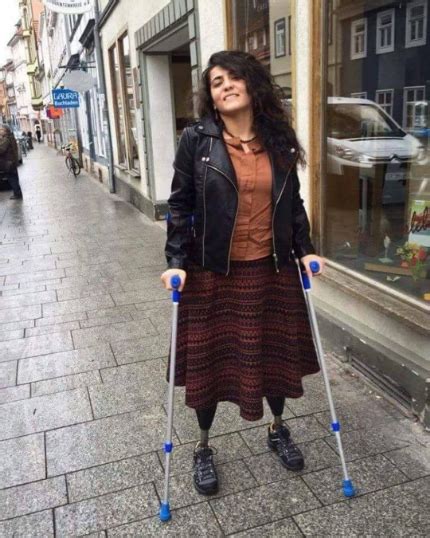 Dak Amputee Girl With Protheses On Crutches 453