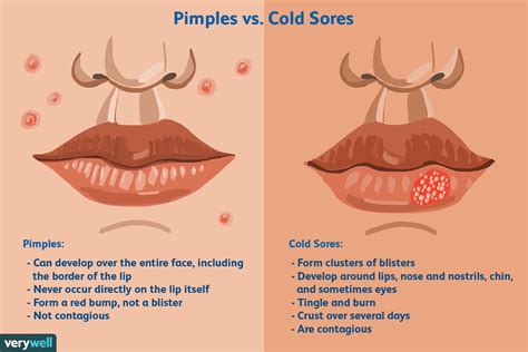 There are many other causes of persistent sores, and all require medical attention. Is It a Cold Sore or Pimple?