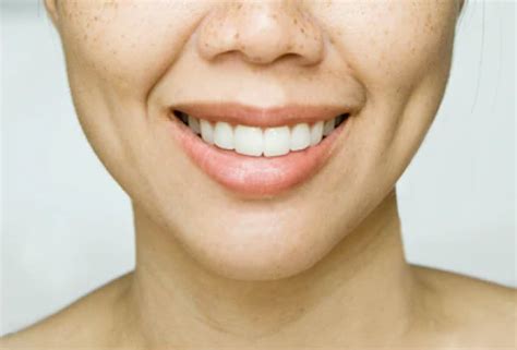 Язвины (на листах при их прилипании). Dimpleplasty In Korea - What is it and how does it work ...