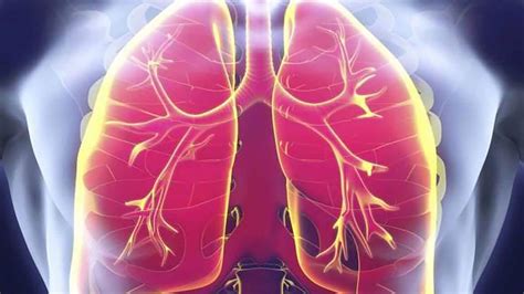 Edema Pulmonar S Ntomas Tratamientos Causas E Informaci N