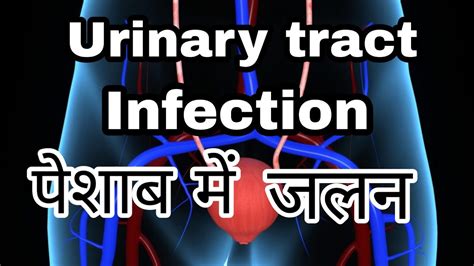 Urinary Tract Infection Uti Symptoms Diagnoses Causes Treatment