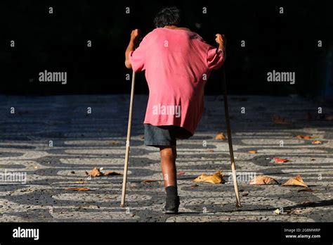 Crutches Amputee Hi Res Stock Photography And Images Alamy