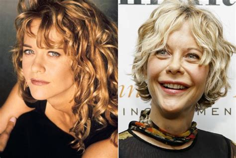 Meg Ryan Before And After Plastic Surgery Celebrity Plastic
