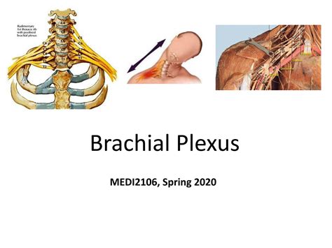 Solution Anatomy Brachial Plexus Studypool