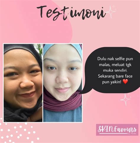 Meet the lms putting collaboration at the heart of the learning by connecting the people, content, and systems that fuel education. Rahsia Kulit Cerah Seawal 4 Hari - Beauty, Cosmetic ...