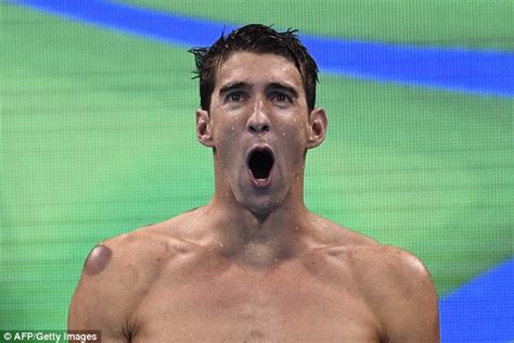 According to our records, he has no children. Michael Phelps shows off marks from the ancient healing ...