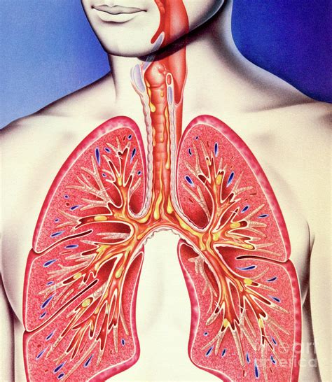 Lower Respiratory Tract Infection Photograph By John Bavosiscience