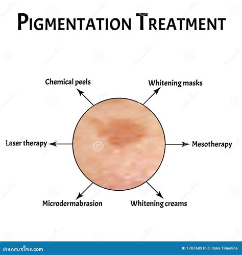 Pigmentation On The Skin Brown Spots On The Skin Pigmentation
