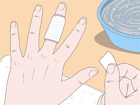 3 Easy Ways To Cure An Infected Finger Wikihow
