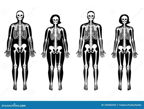 Obese Skeleton Anatomy Vector Illustration 221995190