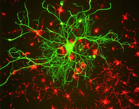 Nerve Growth Factor Key To Living Longer Braintropic
