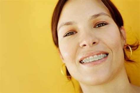 How Much Do Braces Cost Indy Orthodontist