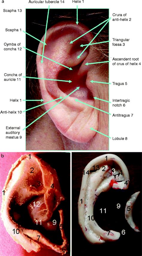 Surgical Anatomy Of The Ear And Neighboring Regions Springerlink