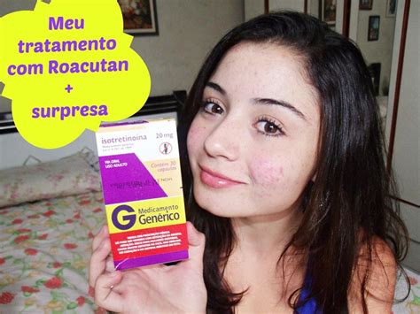 ROACUTAN TRATAMENTO EFICAZ CONTRA ACNE YouTube