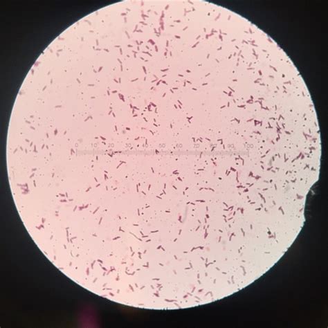 A Dream Within A Dream — Gram Stain Of The Bacillus Subtilis Bacteria