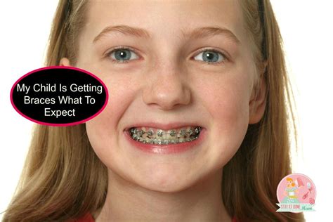 What To Expect When Your Child Gets Braces Stay At Home Mum