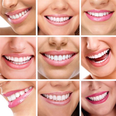 Healthy Teeth For A Beautiful Smile Orthodontic Blog