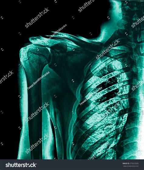 We provide version 1.0, the latest version that has been optimized for different devices. Edit Photos Free Online - X-ray of human | Shutterstock Editor