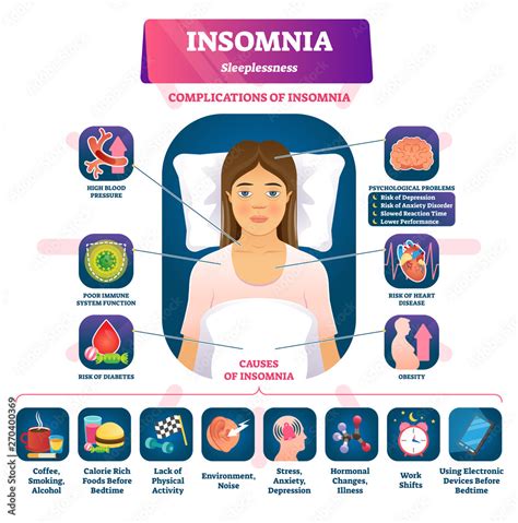 Insomnia Vector Illustration Labeled Sleeplessness Symptoms Causes Scheme Obraz Na Płótnie