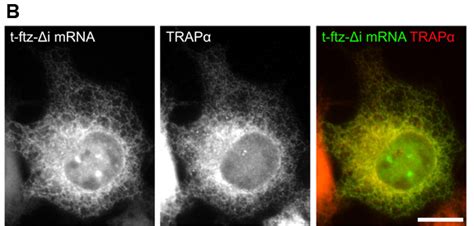 „wir brauchen jeden impfstoff, nichts ist schlechter, als impfstoff liegen zu lassen und nicht zu verimpfen. Analysis of mRNA Nuclear Export Kinetics in Mammalian ...
