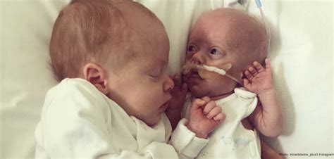 Twin Brothers Snuggles Help Keep 1 Lb Preemie Alive