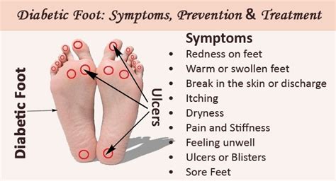 Can Diabetes Cause Foot Problems Diabetes Poster