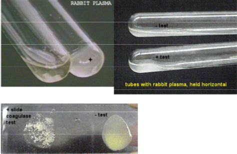 31 Coagulase Test Biology Libretexts
