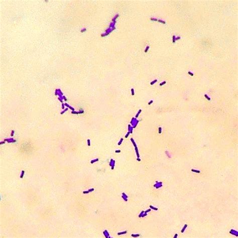Lactobacillus Gram Stain