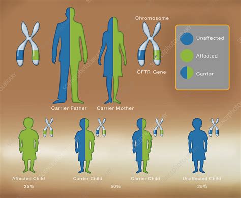 Cystic Fibrosis Mutation Illustration Stock Image C0276883