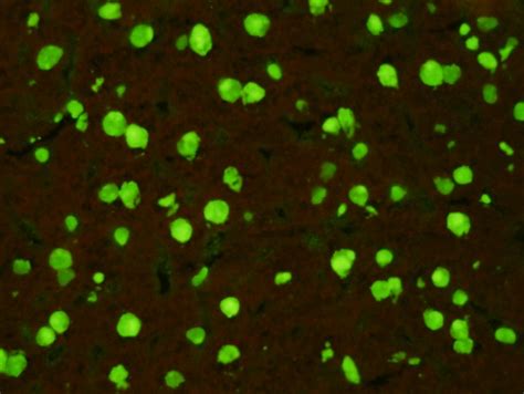 Scimedx Anti Nuclear Antibody Test Kit