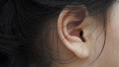 Numerous Genes Shape Ear Lobes