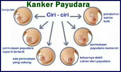 Mengapa jantung sakit saat kaget? MEDIA SENSASI: Wanita, Hati-hati! Jika Muncul 5 Tanda Ini ...