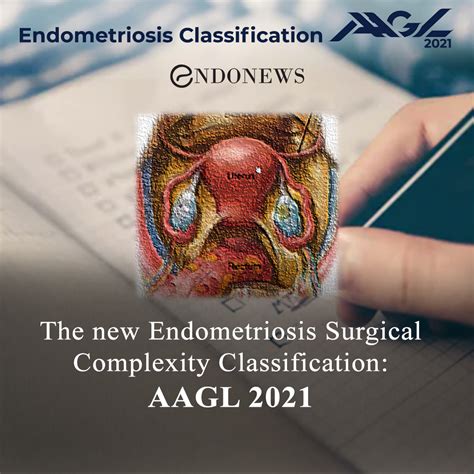 The New Endometriosis Surgical Complexity Classification Aagl 2021