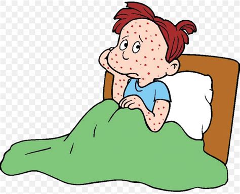 Chickenpox Infection Infectious Disease Clip Art Png 904x734px