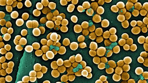 Hospital Acquired Mrsa Infection Rates Falling Cdc Says Fox News