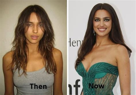 Irina shayk, new york, ny. Did Irina Shayk Undergo Plastic Surgery Including Lips and ...