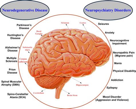 Human Brain Disorders A Review ~ Fulltext
