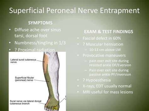 Peroneal Nerve Entrapment Symptoms