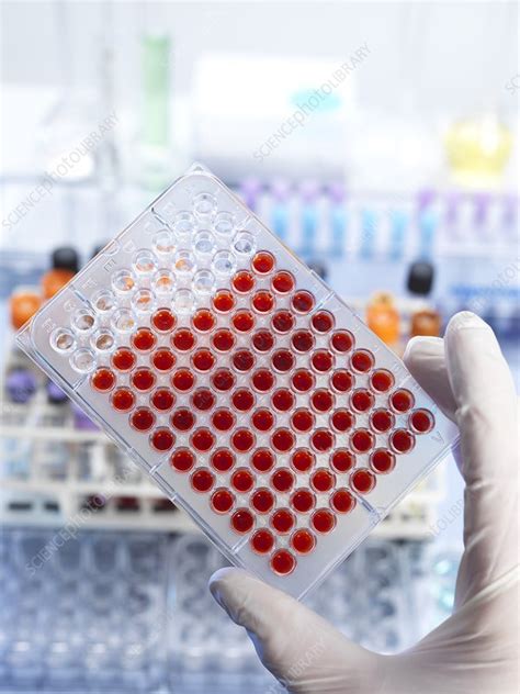 Blood Screening Stock Image F0127428 Science Photo Library