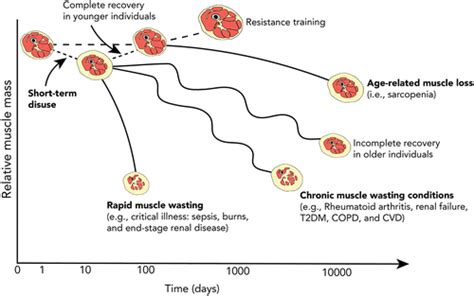 Disuse Induced Skeletal Muscle Atrophy In Disease And Nondisease States