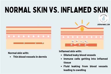 Skin Inflammation 101 Causes And Remedies