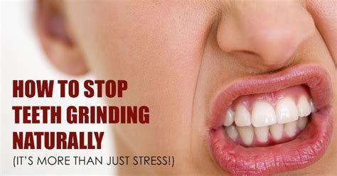 This will stop you from grinding your teeth and clenching your jaw (7), (8). Bruxism: How To Stop Teeth Grinding Naturally (It's Not ...