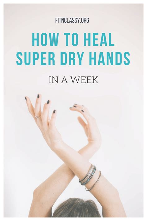 How To Heal Super Dry Hands In A Week Fit And Classy Dry Hands Dry