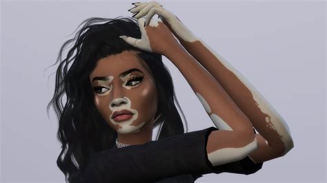 The Sims 4 Cc Vitiligo Ile Ilgili Görsel Sonucu The Sims 4 Skin Sims