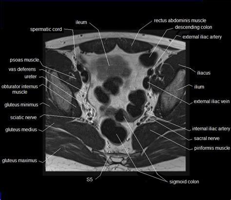 An mri of the knee of a healthy subject was performed in the 3 planes of space (coronal, axial, sagittal) commonly used in osteoarticular imaging, with two weightings most commonly used to. Male Pelvis Anatomy Muscles : Male Left Pelvis And ...